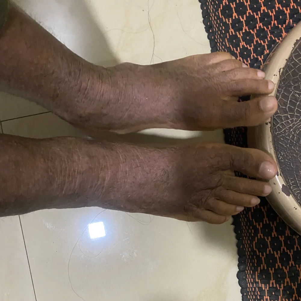 A condition 46
