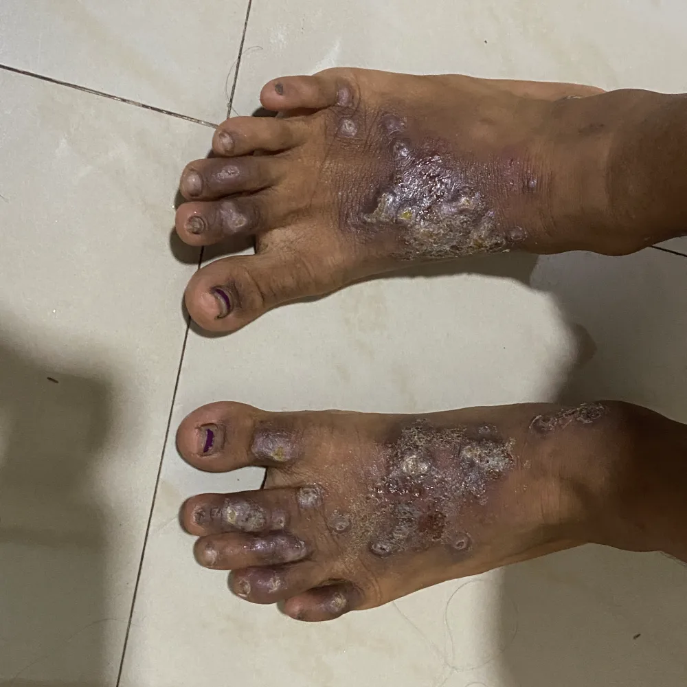 condition 4